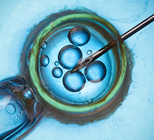 תרומת ביציות: כל מה שחשוב לדעת-תמונה